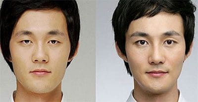 k-pop-korean-plastic-surgery