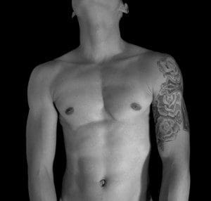 A Flatter and Firmer Chest After Gynecomastia Surgery with Dr. Douglas Steinbrech