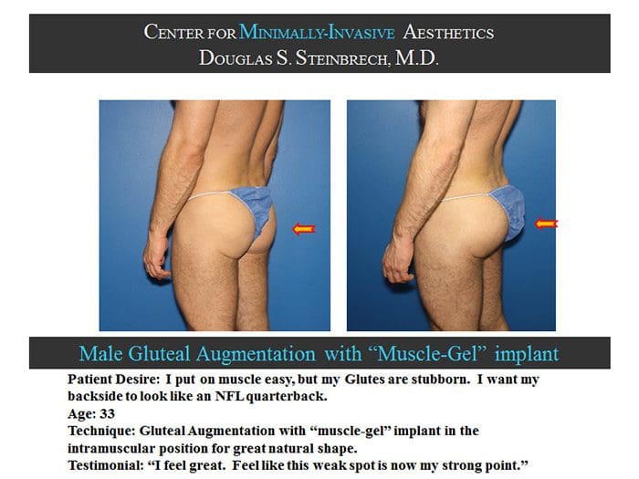 male-glute-5