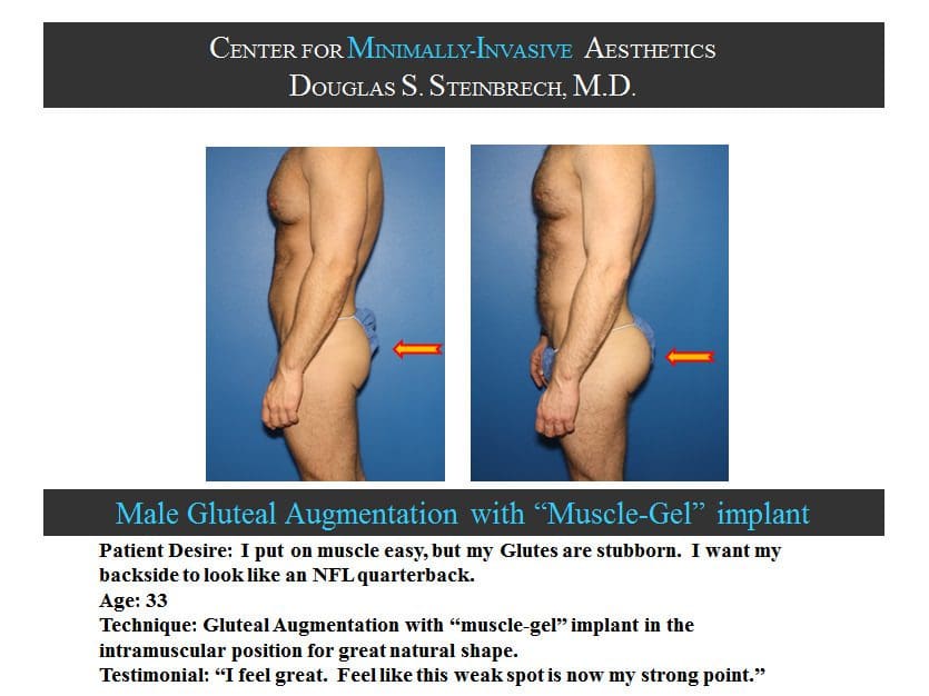 male-glute-7