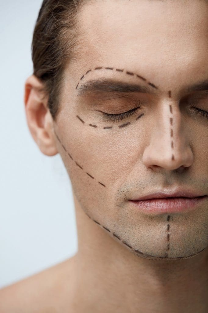 facial implants for men