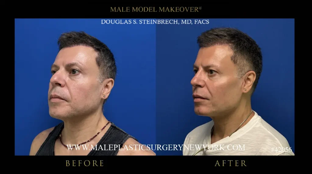 42056-male-model-makeover-45-deg-nyc