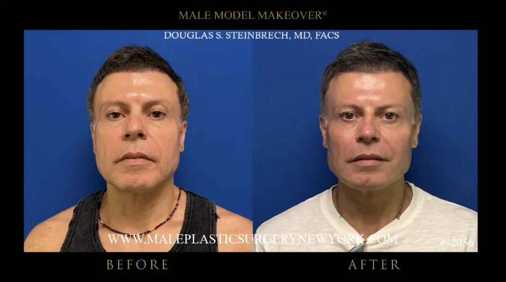 42056-male-model-makeover-frontal-nyc