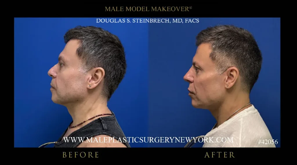 42056-male-model-makeover-left-side-nyc