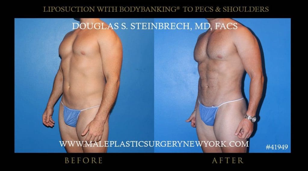 fat grafting surgeon nyc