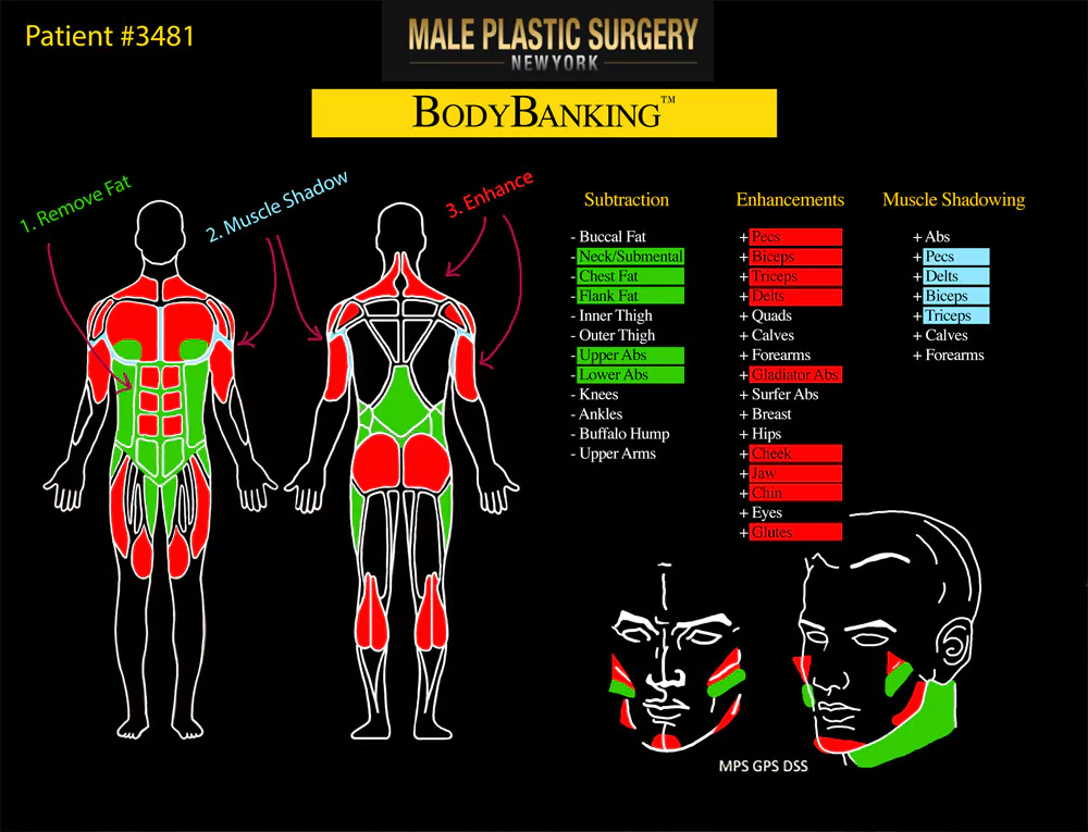 Patient BodyBanking® Color Chart