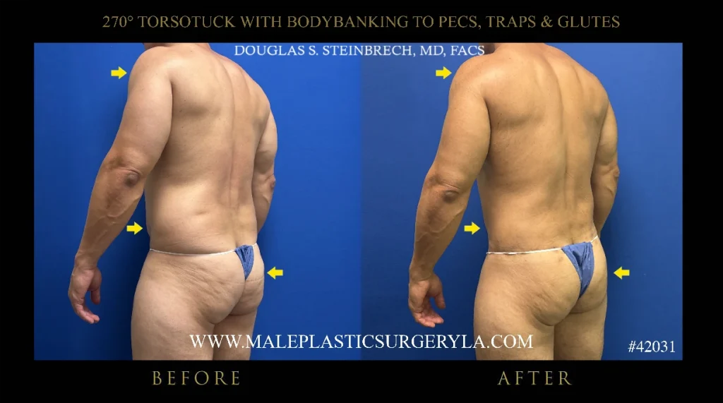 bodybanking-pecs-glutes-nyc-135-degree-back.