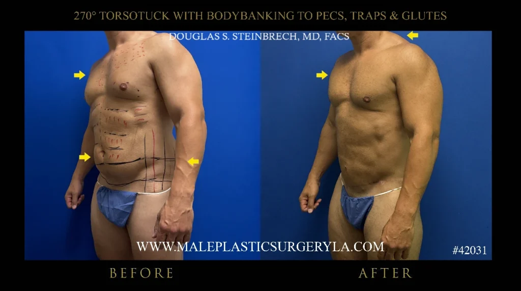extended-torsotuck-new-york-45-degree-angle