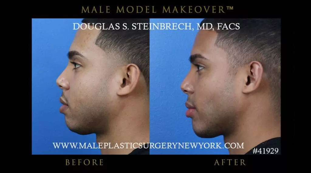 Male Model Makeover® - Before & After