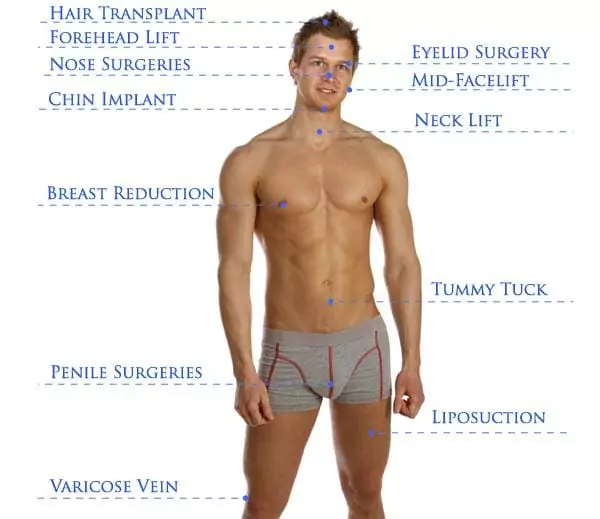 Male Model Plastic Surgery Infographic