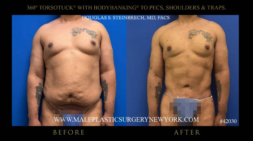 new-york-torsotuck-bodybanking-front-result