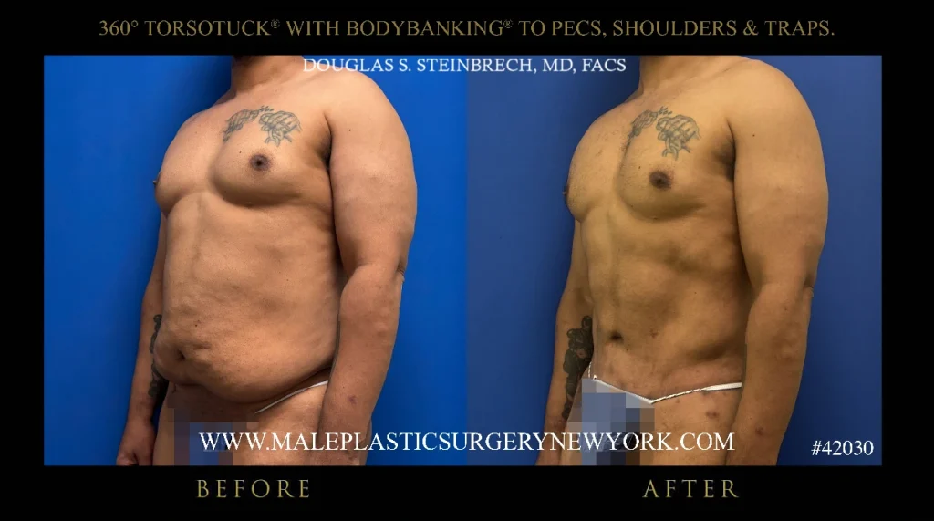 nyc-360-degree-torsotuck-bodybanking-results