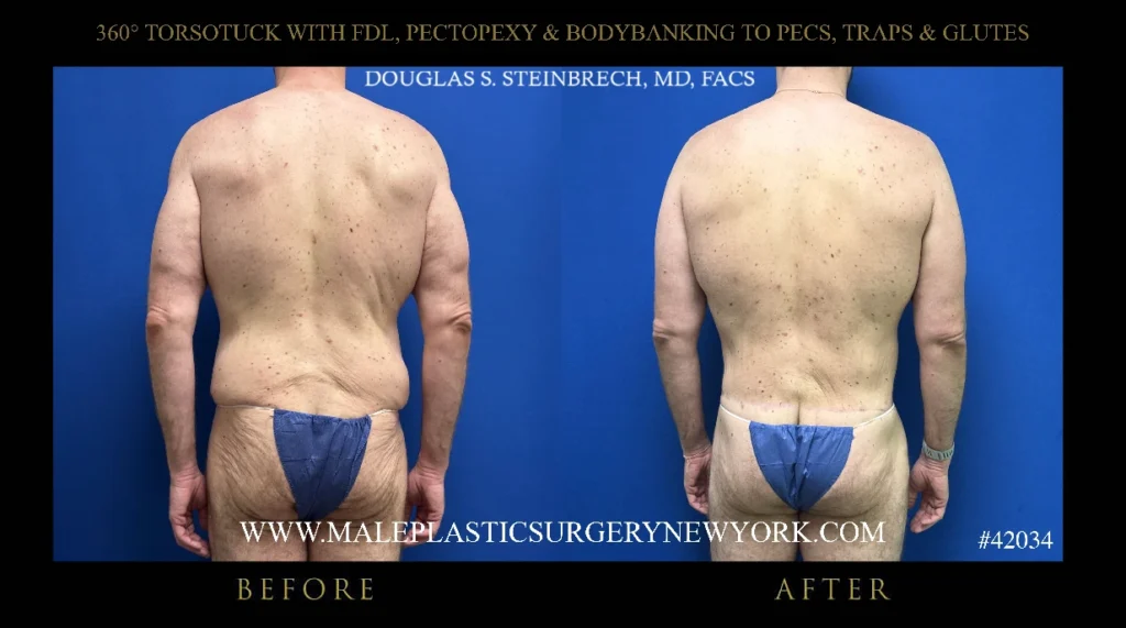 torsotuck-fdl-glutes-straight-on-ny
