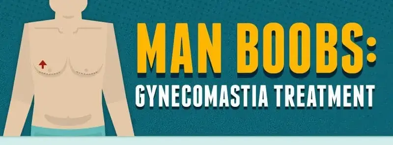 Man Boobs Gynecomastia Treatment